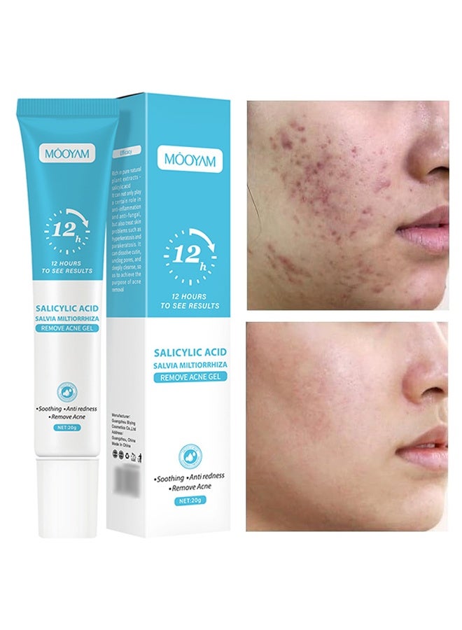 GEL ANTI-ACNÉ À L’ACIDE SALICYLIQUE