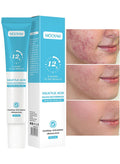 GEL ANTI-ACNÉ À L’ACIDE SALICYLIQUE