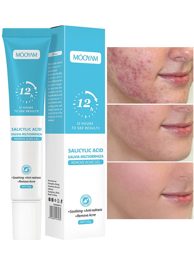 GEL ANTI-ACNÉ À L’ACIDE SALICYLIQUE
