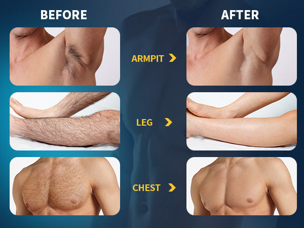 Hair Removal Spray